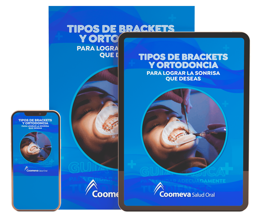 Tipos de Brackets y Ortodoncia Tipos de Brackets y Ortodoncia